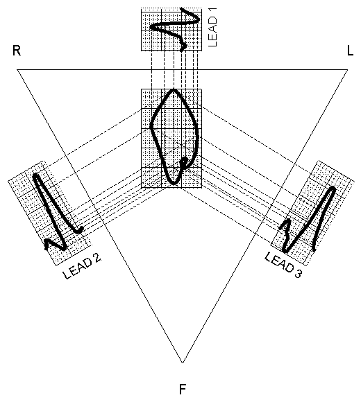 Magnify