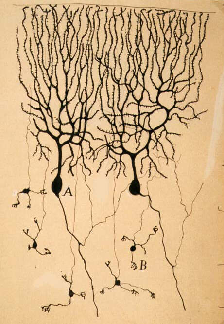 Purkinje Cell